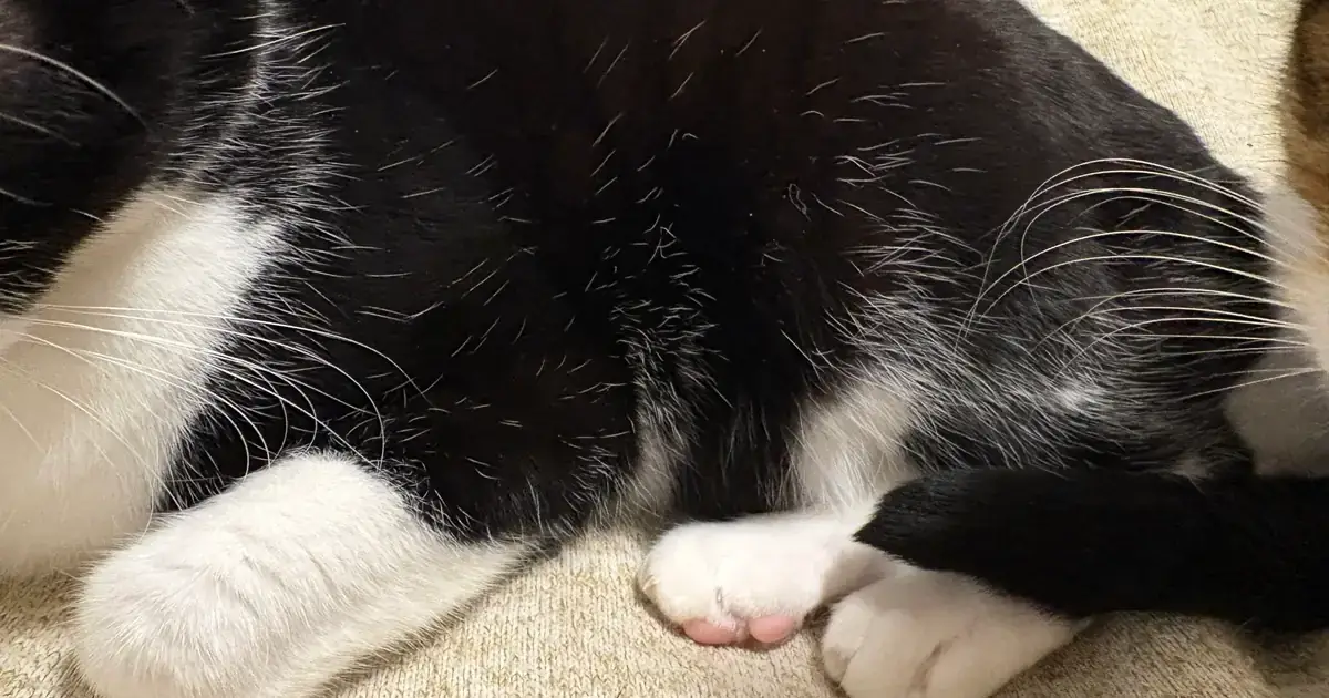 10 年以上前にレーザー脱毛をやったけどもう普通に生えてくるので高いひげ剃りを買ったほうがいいかも